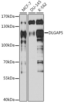 Western blot - DLGAP5 Polyclonal Antibody 