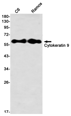 Western blot detection of Cytokeratin 9 in C6,Ramos using Cytokeratin 9 Rabbit mAb(1:1000 diluted)