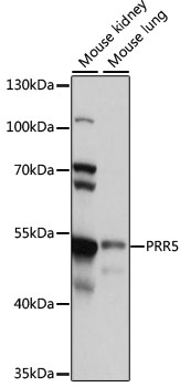 Western blot - PRR5 Polyclonal Antibody 