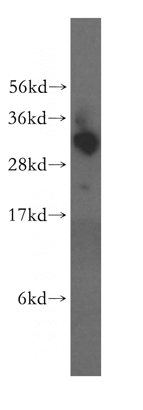 HeLa cells were subjected to SDS PAGE followed by western blot with Catalog No:115870(TBCB antibody) at dilution of 1:500