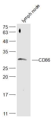 Fig2: Sample:; Lymph node(Mouse)Cell Lysate at 40 ug; Primary: Anti-CD86 at 1/300 dilution; Secondary: IRDye800CW Goat Anti-Rabbit IgG at 1/20000 dilution; Predicted band size: 31 kD; Observed band size: 31 kD