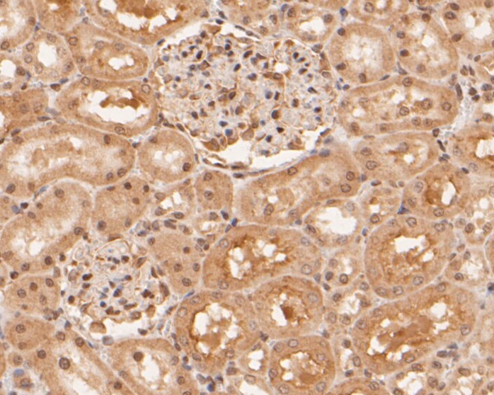 Fig5: Immunohistochemical analysis of paraffin-embedded rat kidney tissue using anti-RBPMS antibody. The section was pre-treated using heat mediated antigen retrieval with sodium citrate buffer (pH 6.0) for 20 minutes. The tissues were blocked in 5% BSA for 30 minutes at room temperature, washed with ddH2O and PBS, and then probed with the primary antibody ( 1/50) for 30 minutes at room temperature. The detection was performed using an HRP conjugated compact polymer system. DAB was used as the chromogen. Tissues were counterstained with hematoxylin and mounted with DPX.