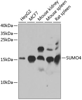 Western blot - SUMO4 Polyclonal Antibody 