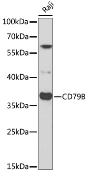 Western blot - CD79B Polyclonal Antibody 