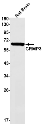 Western blot detection of CRMP3 in Rat Brain lysates using CRMP3 Rabbit mAb(1:1000 diluted).Predicted band size:62kDa.Observed band size:62kDa.