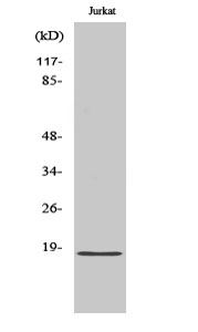 Fig1:; Western Blot analysis of various cells using KEPI Polyclonal Antibody diluted at 1: 1000