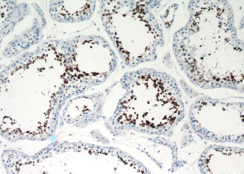 Immunohistochemistry of paraffin-embedded human testis tissue slide using Catalog No:108825(CLGN Antibody) at dilution of 1:50 (under 10x lens)