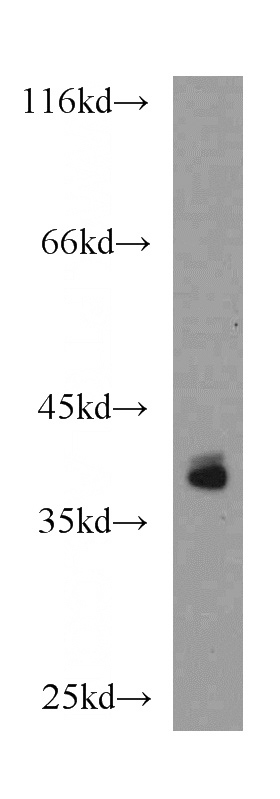 mouse skeletal muscle tissue were subjected to SDS PAGE followed by western blot with Catalog No:111646(IKIP antibody) at dilution of 1:500