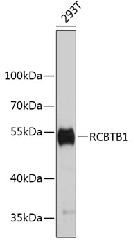 Western blot - RCBTB1 Polyclonal Antibody 