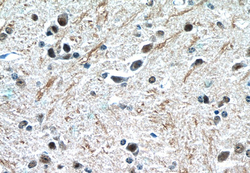 Immunohistochemistry of paraffin-embedded mouse brain tissue slide using Catalog No:114789(RORB Antibody) at dilution of 1:200 (under 40x lens)
