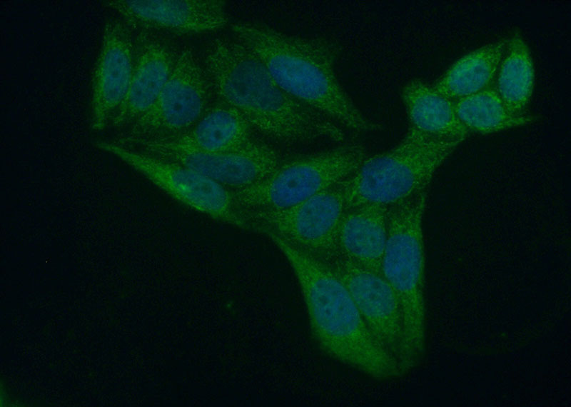 Immunofluorescent analysis of (10% Formaldehyde) fixed HeLa cells using Catalog No:117168(ZNF385A Antibody) at dilution of 1:50 and Alexa Fluor 488-congugated AffiniPure Goat Anti-Rabbit IgG(H+L)