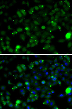 Immunofluorescence - TAGLN2 Polyclonal Antibody 