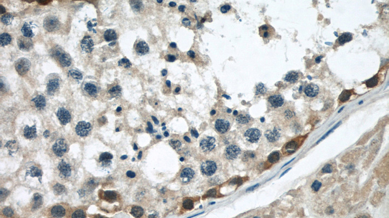 Immunohistochemical of paraffin-embedded human testis using Catalog No:107767(ADAM5P antibody) at dilution of 1:50 (under 40x lens)