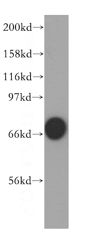 K-562 cells were subjected to SDS PAGE followed by western blot with Catalog No:116798(VRK2 antibody) at dilution of 1:500