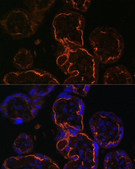 Immunofluorescence - LDB3 Polyclonal Antibody 