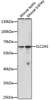 Western blot - SLC2A5 Polyclonal Antibody 
