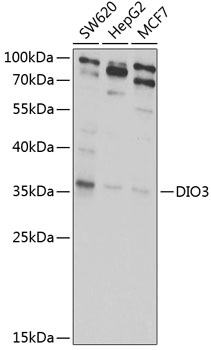 Western blot - DIO3 Polyclonal Antibody 