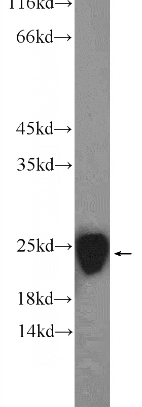 rat brain tissue were subjected to SDS PAGE followed by western blot with Catalog No:114271(PTGES3 Antibody) at dilution of 1:1000
