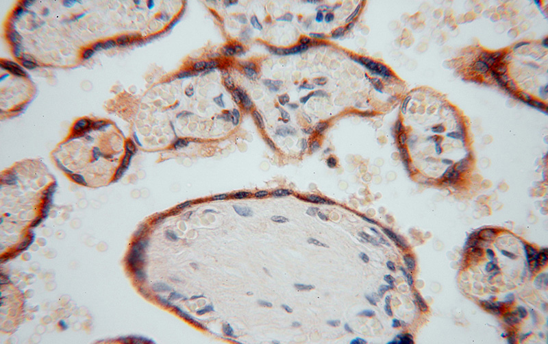 Immunohistochemical of paraffin-embedded human placenta using Catalog No:113622(PDIA5 antibody) at dilution of 1:100 (under 40x lens)