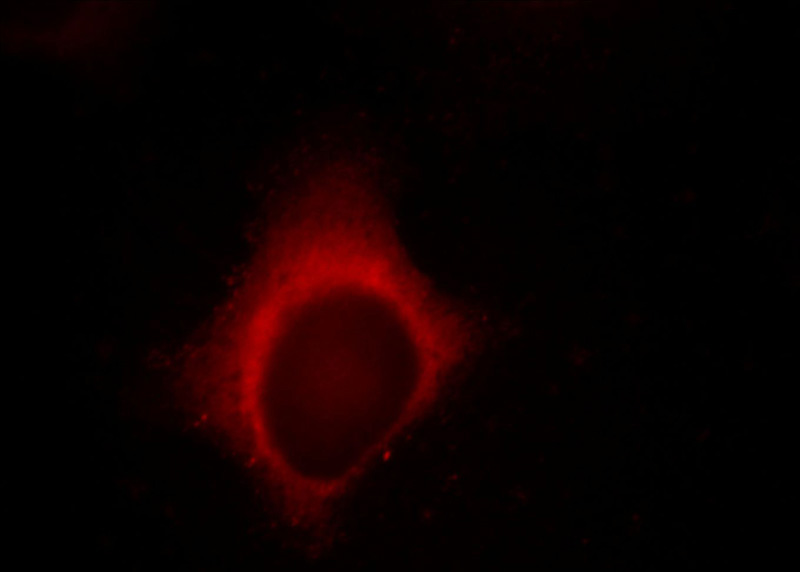 Immunofluorescent analysis of Hela cells, using NEFM antibody Catalog No:113163 at 1:25 dilution and Rhodamine-labeled goat anti-rabbit IgG (red).