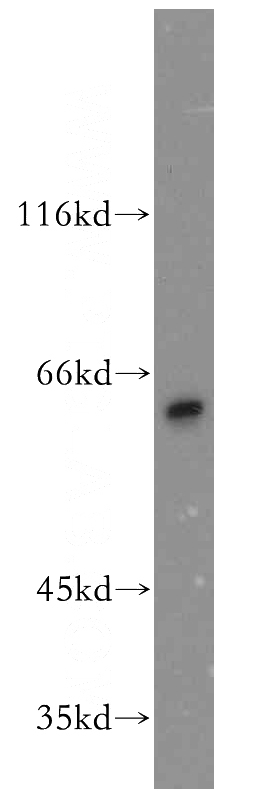 mouse cerebellum tissue were subjected to SDS PAGE followed by western blot with Catalog No:109572(DPYSL3 antibody) at dilution of 1:400