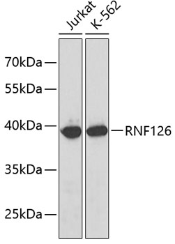 Western blot - RNF126 Polyclonal Antibody 