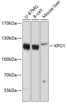 Western blot - XPO1 Polyclonal Antibody 