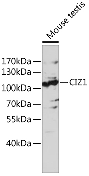 Western blot - CIZ1 Polyclonal Antibody 