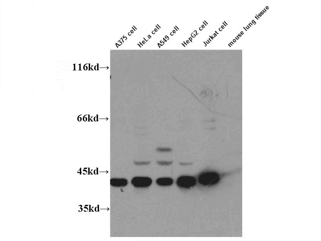 WB result of Catalog No:110363 (ERK1 antibody) with various lysates at dilution of 1:1000.