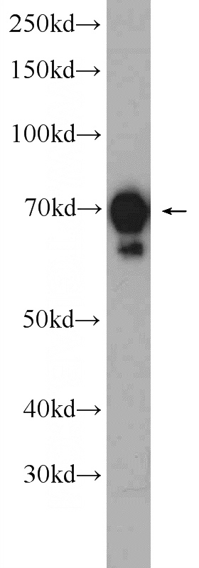 K-562 cells were subjected to SDS PAGE followed by western blot with Catalog No:111569(HSPA1B Antibody) at dilution of 1:1000