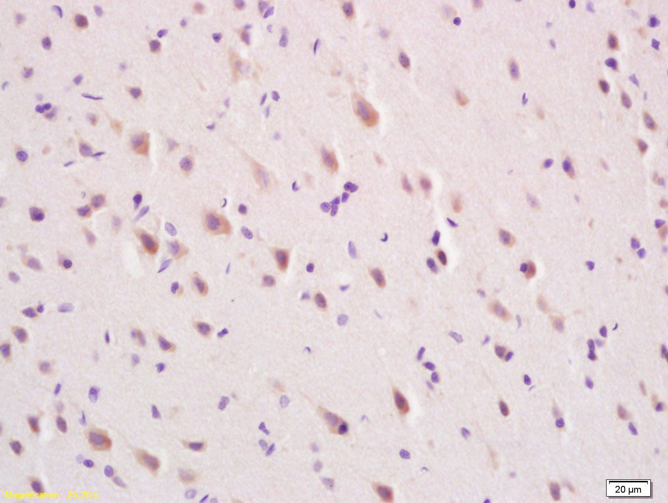 Fig1: Tissue/cell: rat brain tissue; 4% Paraformaldehyde-fixed and paraffin-embedded;; Antigen retrieval: citrate buffer ( 0.01M, pH 6.0 ), Boiling bathing for 15min; Block endogenous peroxidase by 3% Hydrogen peroxide for 30min; Blocking buffer (normal goat serum,C-0005) at 37℃ for 20 min;; Incubation: Anti-MFSD2A Polyclonal Antibody, Unconjugated 1:200, overnight at 4℃, followed by conjugation to the secondary antibody(SP-0023) and DAB(C-0010) staining