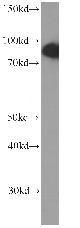 HeLa cells were subjected to SDS PAGE followed by western blot with Catalog No:107534(USP5 Antibody) at dilution of 1:1000