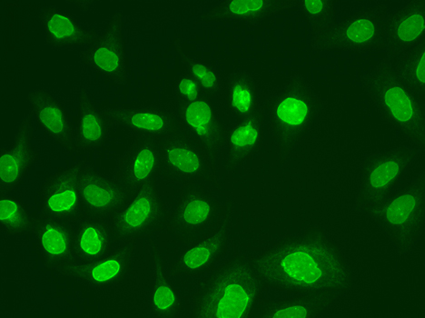 Immunofluorescence - UBE2V1 Polyclonal Antibody 