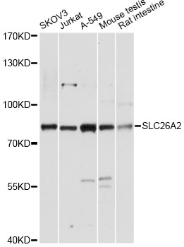 Western blot - SLC26A2 Polyclonal Antibody 