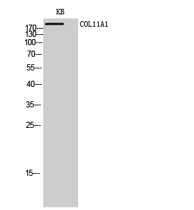 Fig1:; Western Blot analysis of KB cells using COL11A1 Polyclonal Antibody diluted at 1: 1000