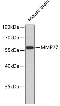Western blot - MMP27 Polyclonal Antibody 