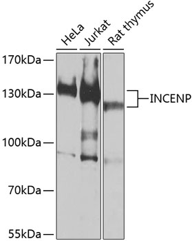 Western blot - INCENP Polyclonal Antibody 