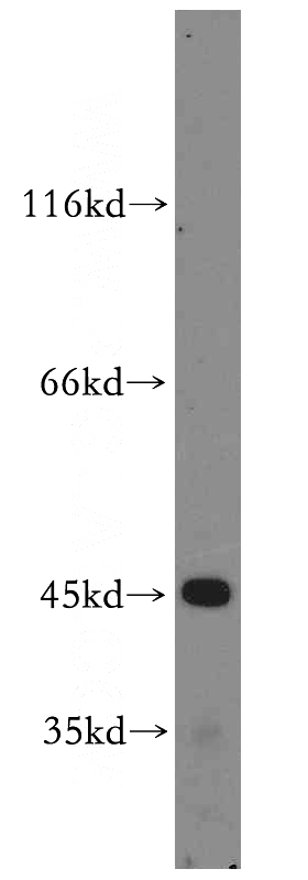 HepG2 cells were subjected to SDS PAGE followed by western blot with Catalog No:109699(CYP2W1 antibody) at dilution of 1:400