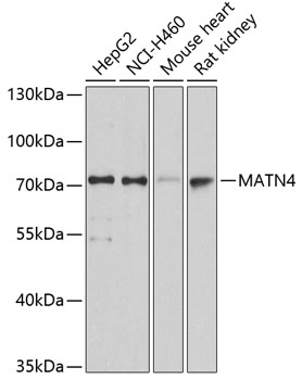 Western blot - MATN4 Polyclonal Antibody 