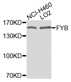 Western blot - FYB Monoclonal Antibody 