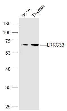Fig1: Sample:; Bone(Rat) Cell Lysate at 40 ug; Thymus(Rat) Cell Lysate at 40 ug; Primary: Anti-LRRC33 at 1/300 dilution; Secondary: IRDye800CW Goat Anti-Rabbit IgG at 1/20000 dilution; Predicted band size: 74 kD; Observed band size: 74 kD