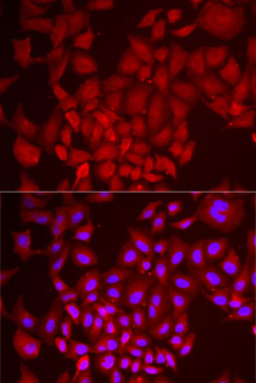 Immunofluorescence - DCAF7 Polyclonal Antibody 