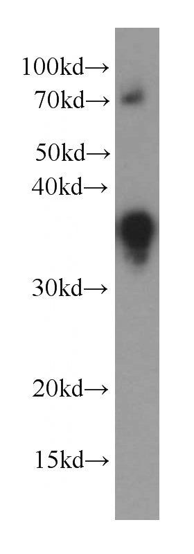 Recombinant protein were subjected to SDS PAGE followed by western blot with Catalog No:107381(IL16 antibody) at dilution of 1:20000