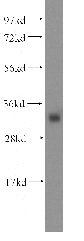 human liver tissue were subjected to SDS PAGE followed by western blot with Catalog No:111877(IYD antibody) at dilution of 1:1000