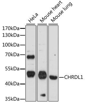 Western blot - CHRDL1 Polyclonal Antibody 