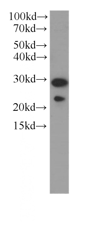 HeLa cells were subjected to SDS PAGE followed by western blot with Catalog No:107468(PGRMC2 antibody) at dilution of 1:1000