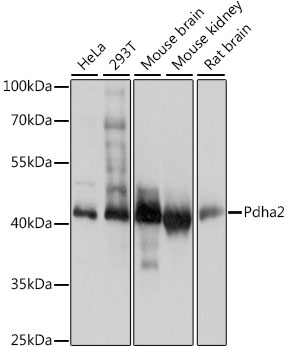 Western blot - PDHA2 Polyclonal Antibody 