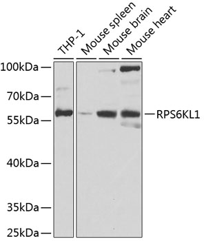 Western blot - RPS6KL1 Polyclonal Antibody 