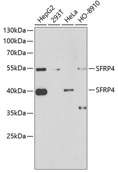 Western blot - SFRP4 Polyclonal Antibody 