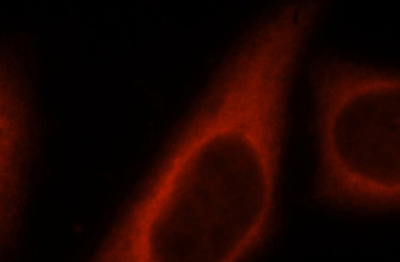Immunofluorescent analysis of HepG2 cells, using ACLY antibody Catalog No:108336 at 1:25 dilution and Rhodamine-labeled goat anti-rabbit IgG (red).